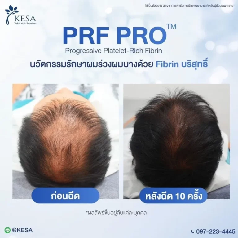 LINE ALBUM PRF PRO 250116 4 0 920×920