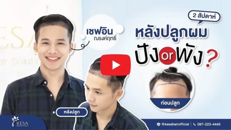 NNN เกศา คลินิก - kesa hair clinic