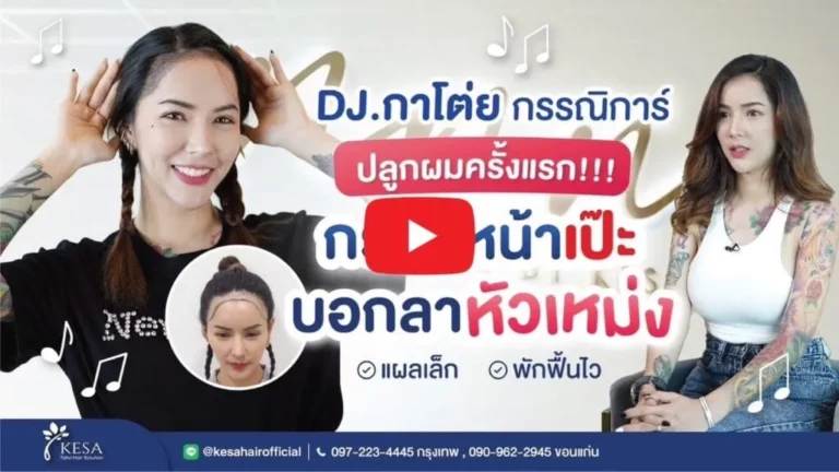ปลูกผมผู้หญิง เกศา คลินิก - kesa hair clinic