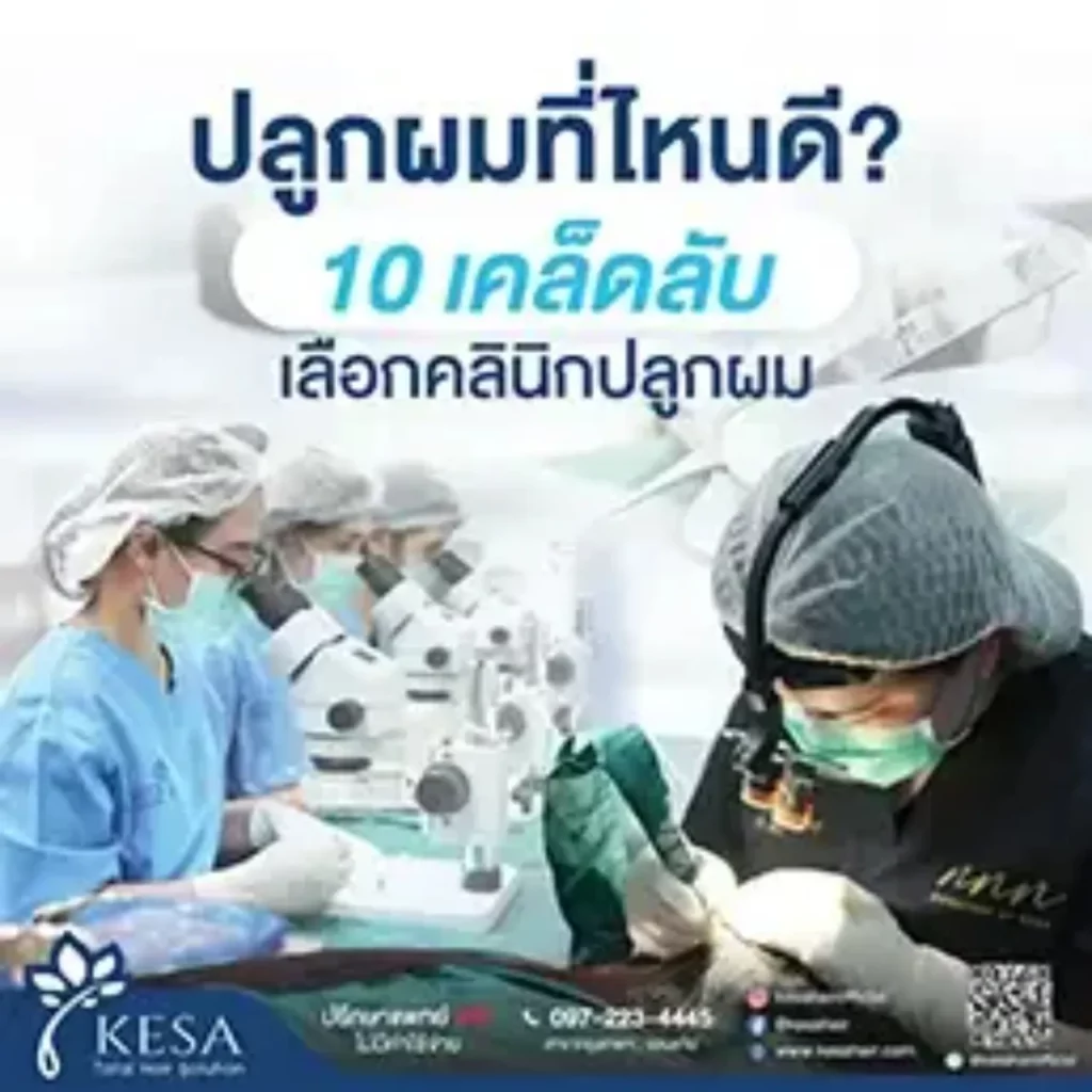ปลูกผมที่ไหนดี ? 10เคล็ดลับเลือกคลินิกปลูกผม เกศา คลินิก - kesa hair clinic