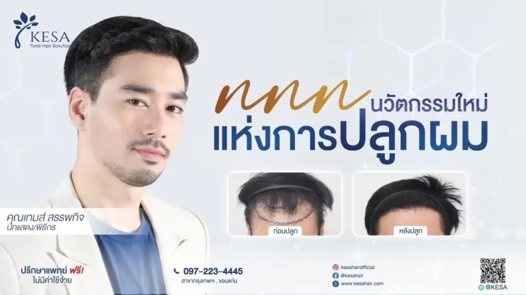 ปลูกผมทีไ่หนดี 2568 เกศา คลินิก - kesa hair clinic