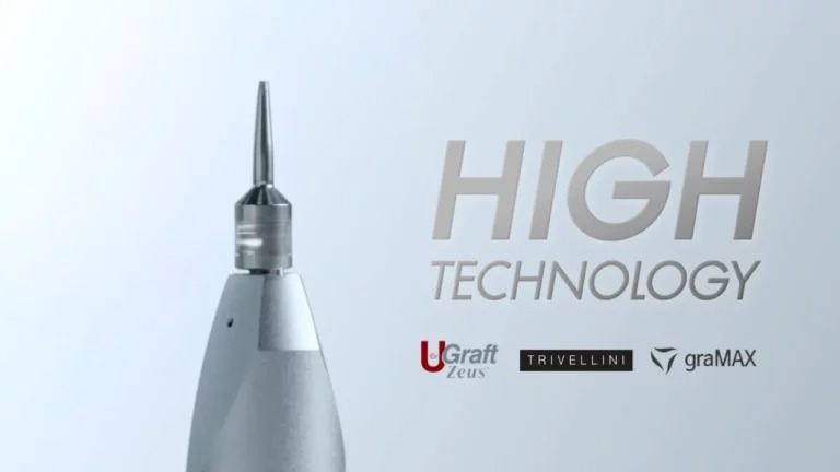 maxresdefault 17 768×432 เกศา คลินิก - kesa hair clinic