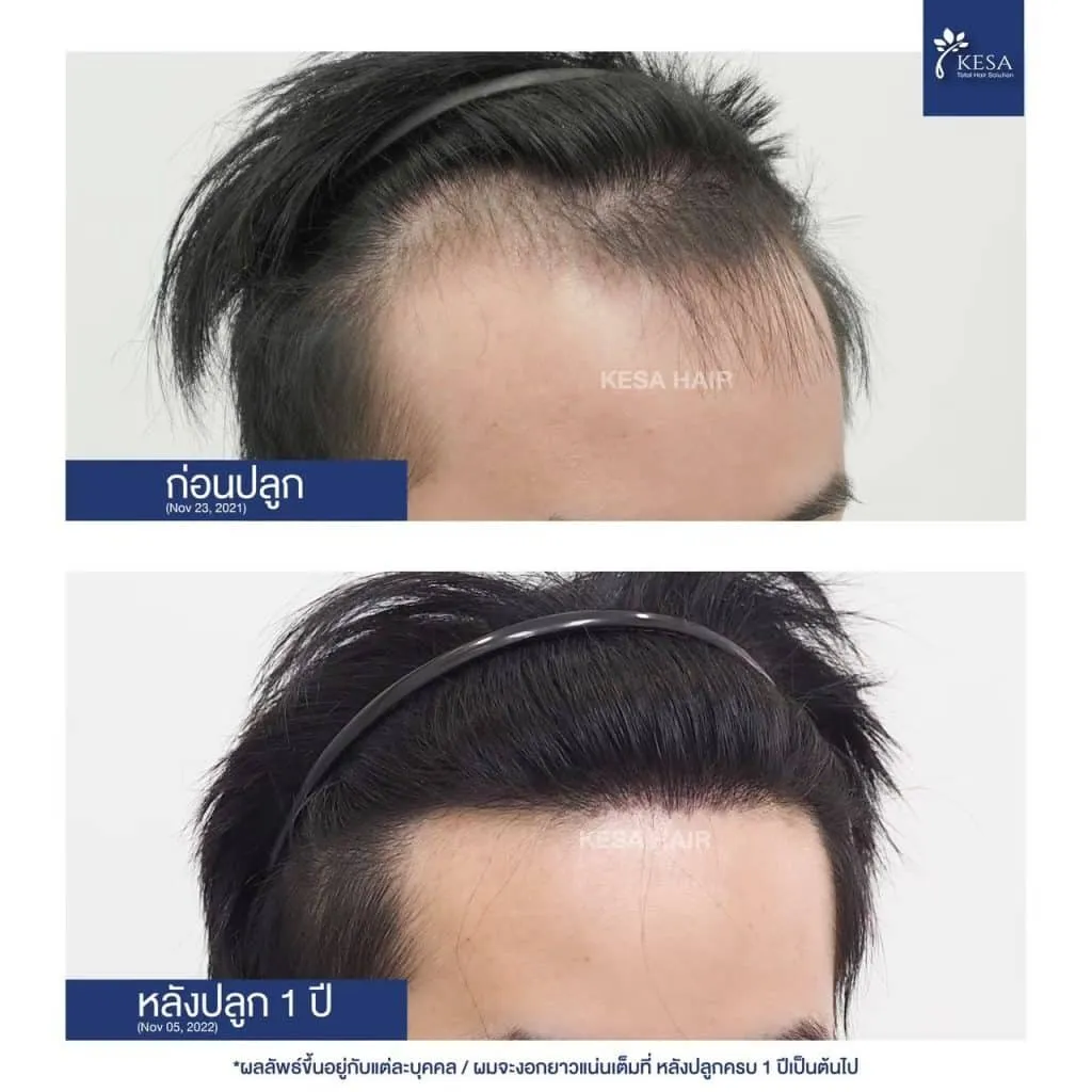 ทิศทางและการเรียงลำดับกราฟเลียนแบบธรรมชาติ