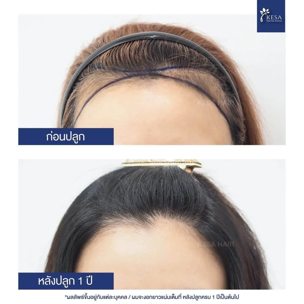 ความหนาแน่นสูงเทียบความหนาแน่นธรรมชาติ