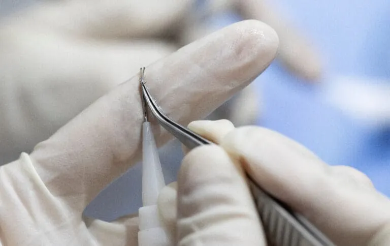 shutterstock_1706781001-768x484 – เกศา คลินิก - kesa hair clinic DHI เกศา คลินิก - kesa hair clinic