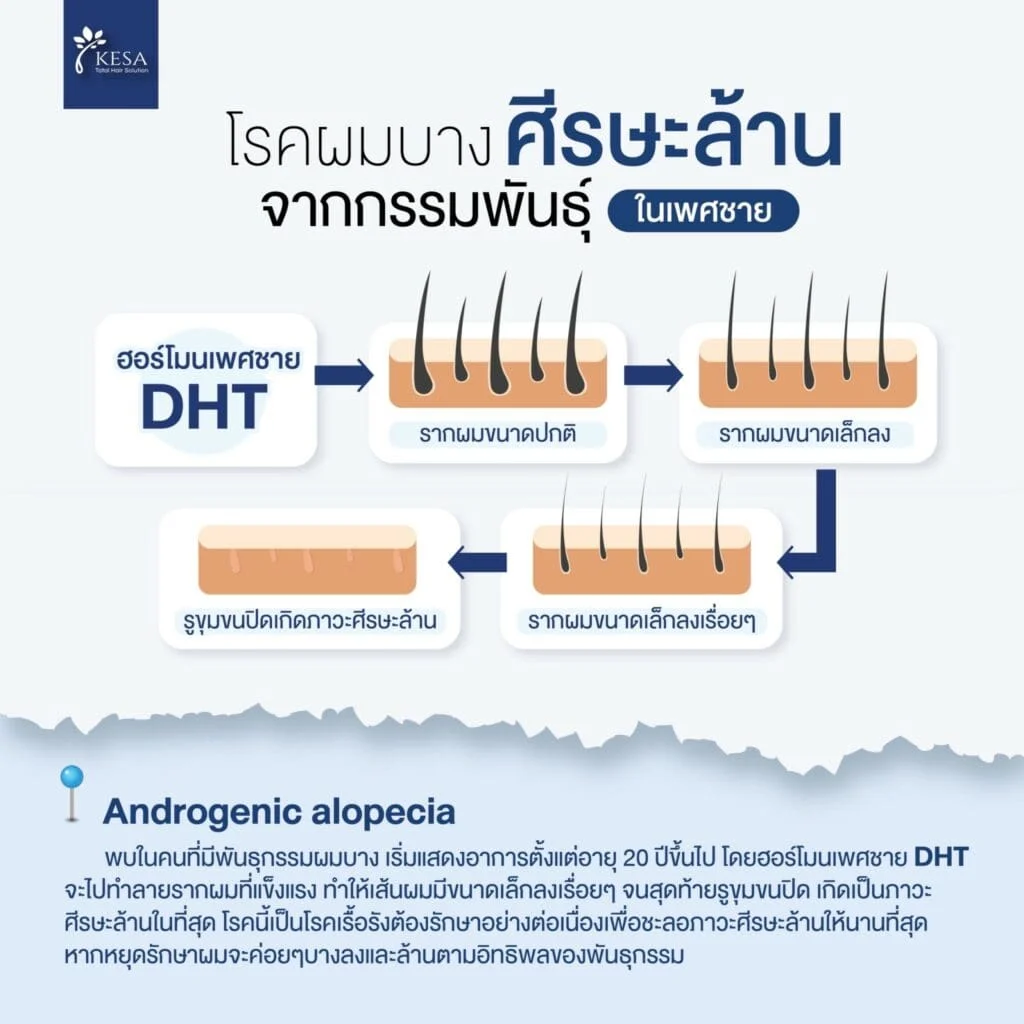 DHT