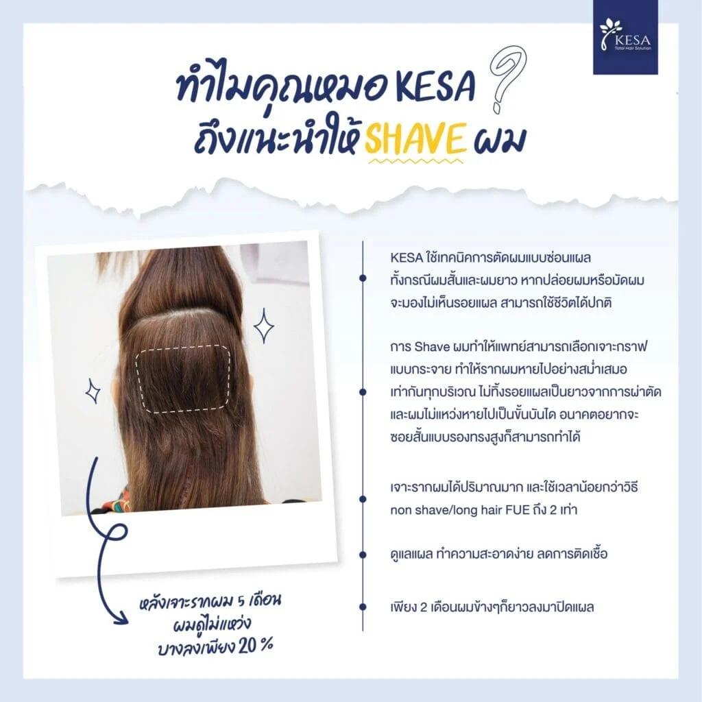 ปลูกผมผู้หญิง