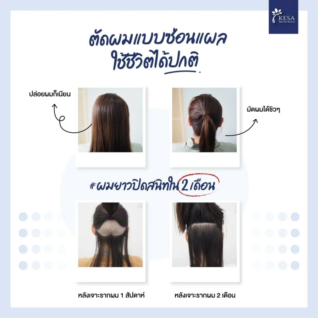 ตัดผมแบบเก็บแผล