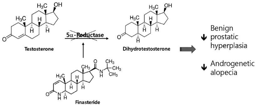 Finasteride เกศา คลินิก - kesa hair clinic