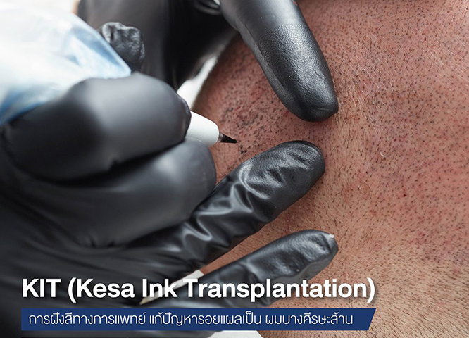  เกศา คลินิก - kesa hair clinic