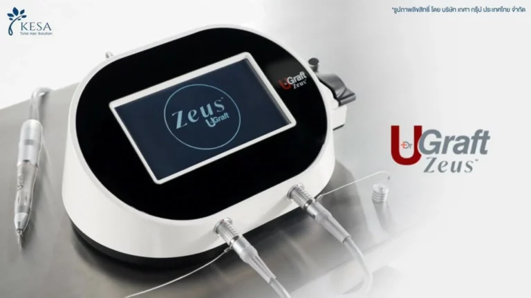 U GRAFT เกศา คลินิก - kesa hair clinic