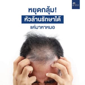 androgenic alopecia เกศา คลินิก - kesa hair clinic