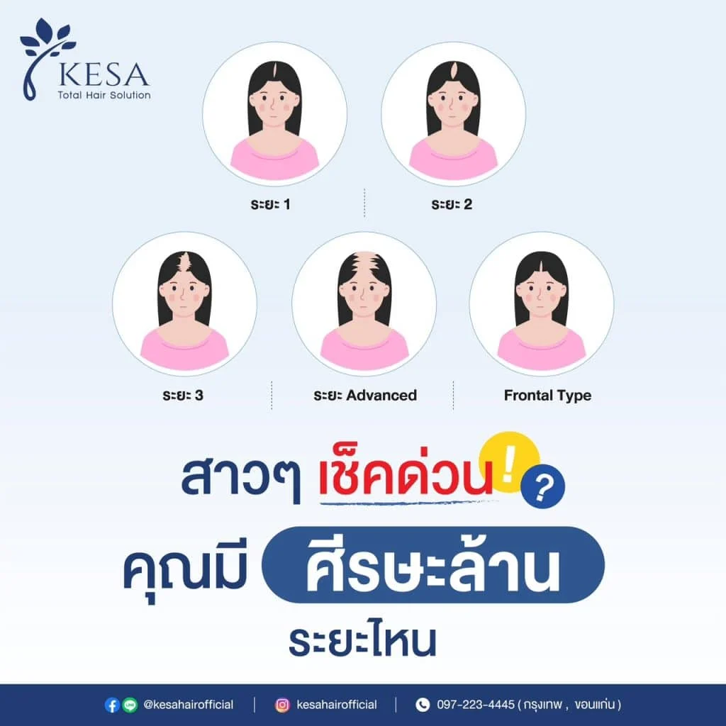 LINE_ALBUM_Content_230823_1-1024x1024 – เกศา คลินิก - kesa hair clinic สาวๆเช็คด่วนคุณมี ศีรษะล้าน