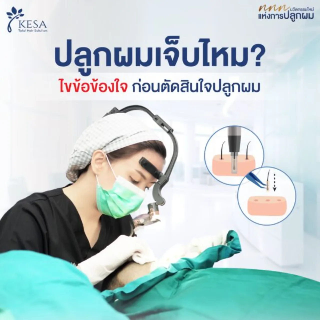 ปลูก ผม เจ็บ ไหม