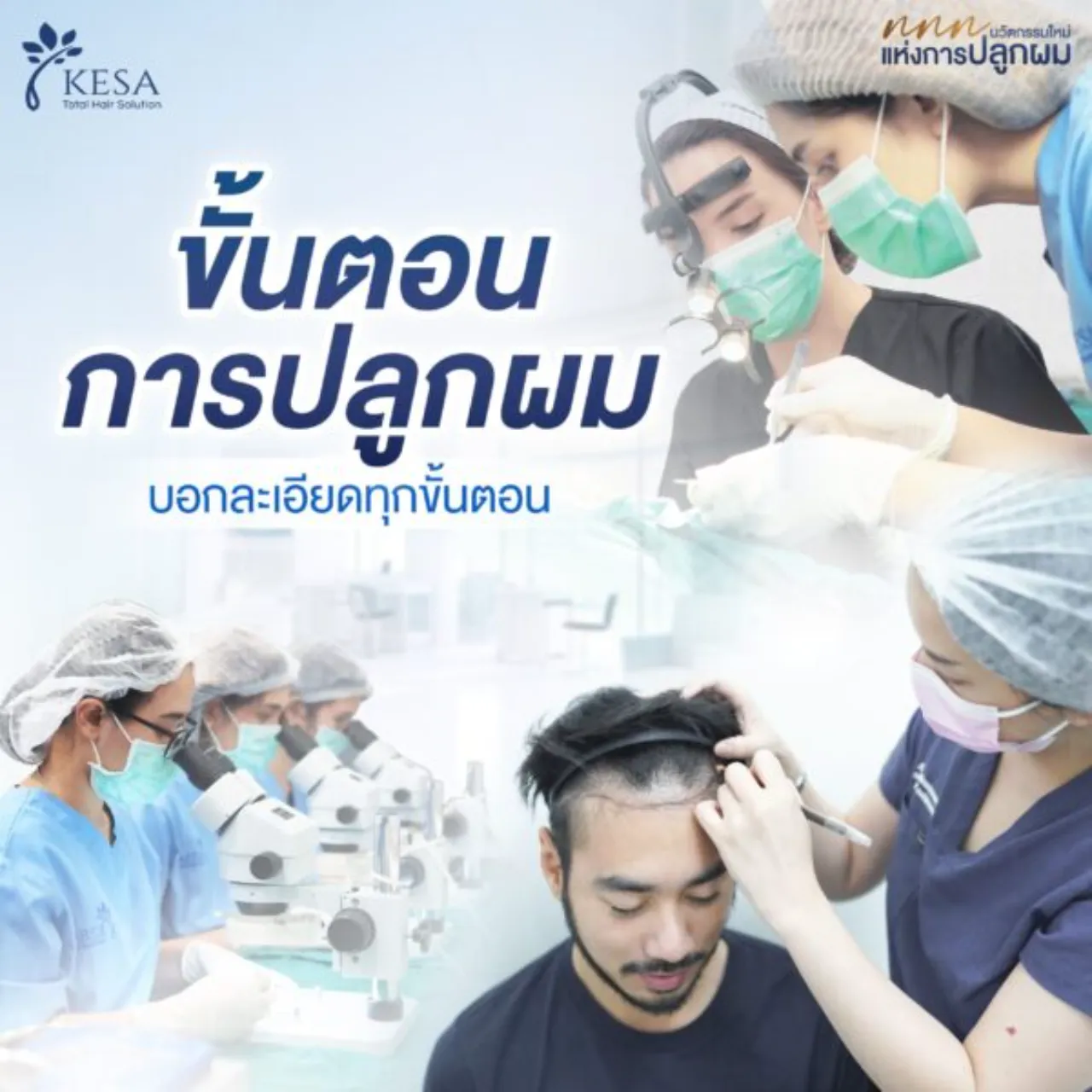 ขั้นตอนการปลูกผม บอกละเอียดทุกขั้นตอน
