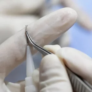 DHI เกศา คลินิก - kesa hair clinic