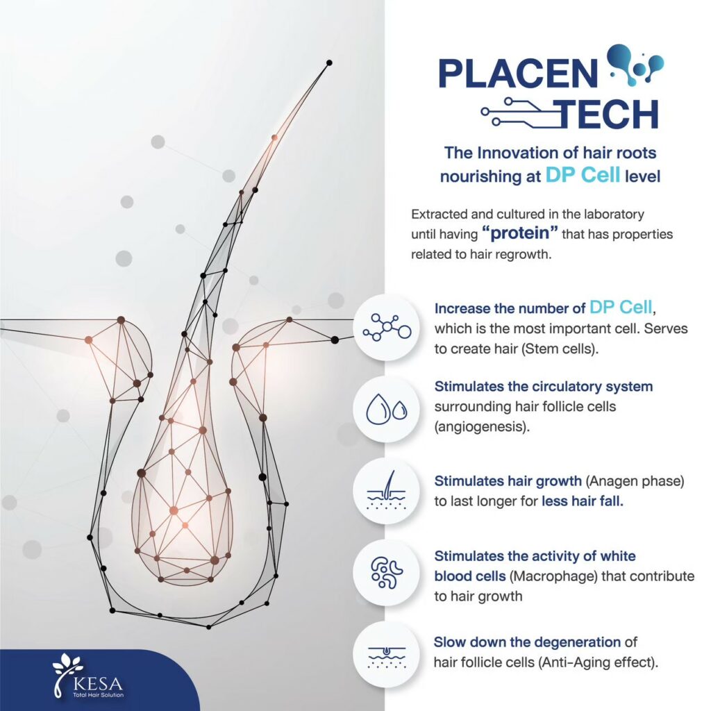  เกศา คลินิก - kesa hair clinic