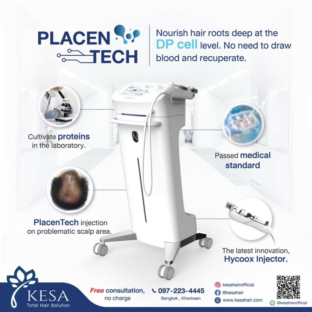  เกศา คลินิก - kesa hair clinic