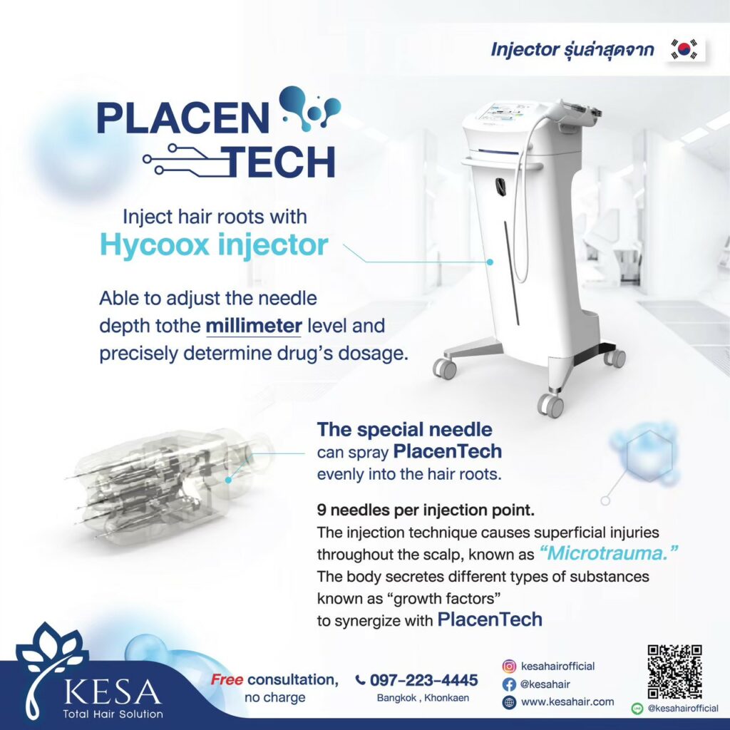  เกศา คลินิก - kesa hair clinic