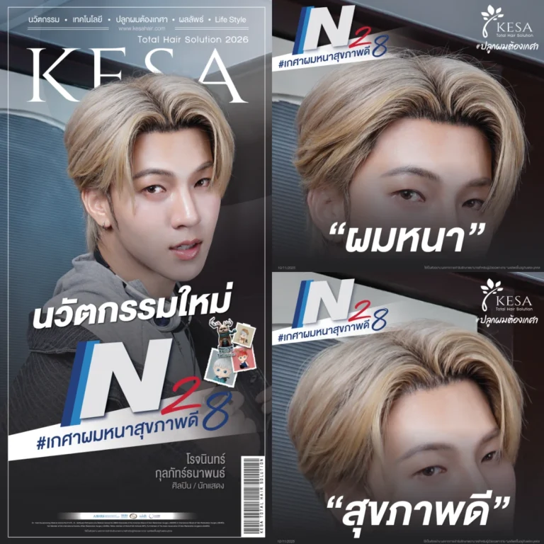 N8 รีวิวปลูกผมผู้ชาย