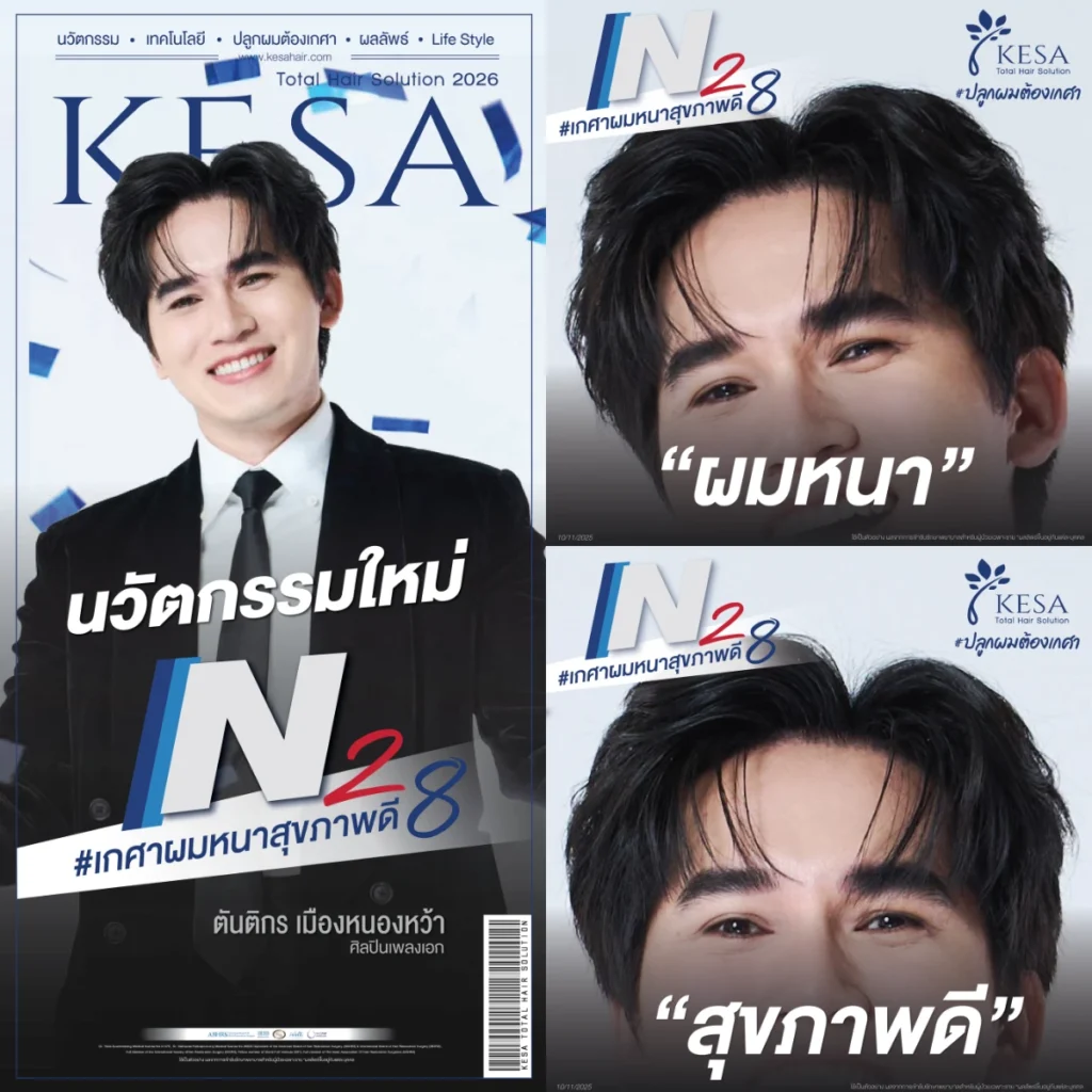 N28 #เกศสผมหนาสุขภาพดี