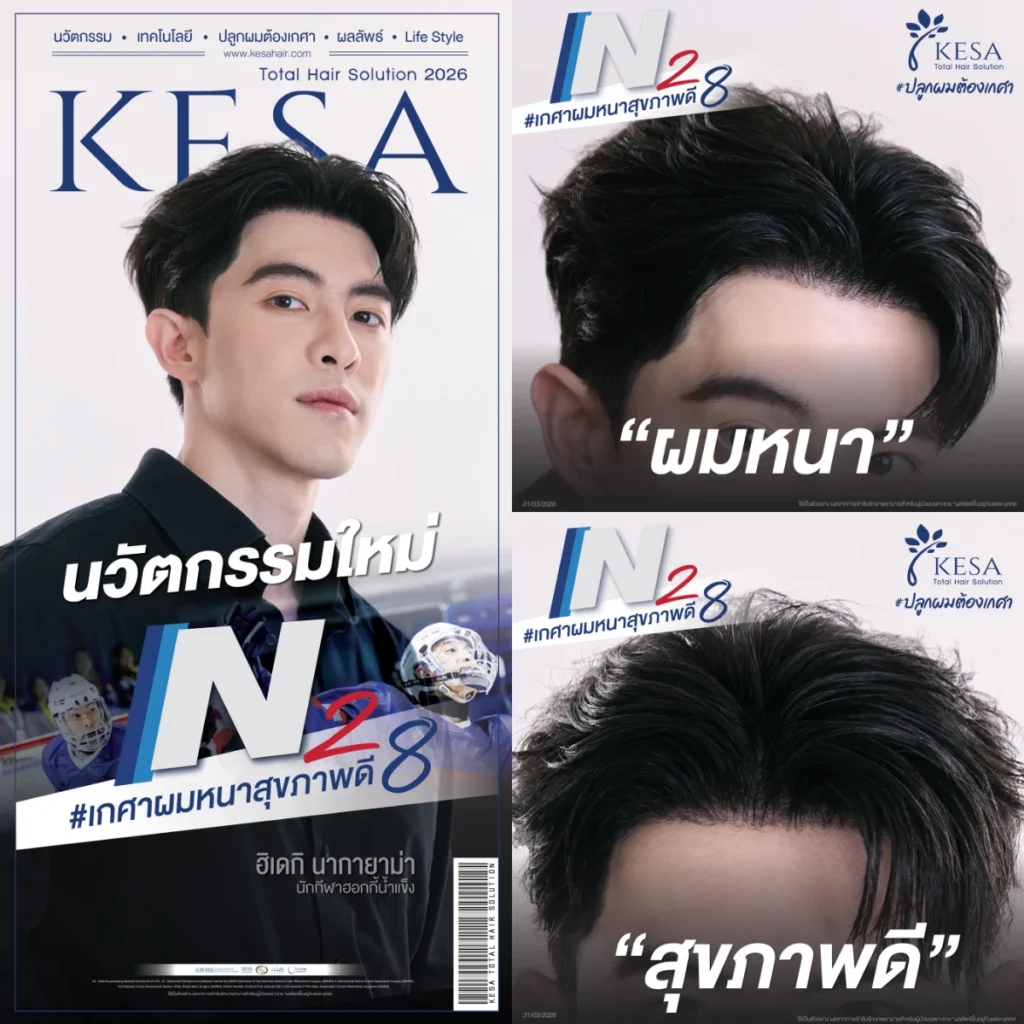 N28 #เกศสผมหนาสุขภาพดี