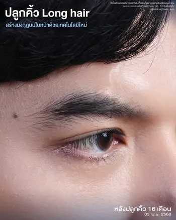 ปลูกคิ้ว ที่เกศา