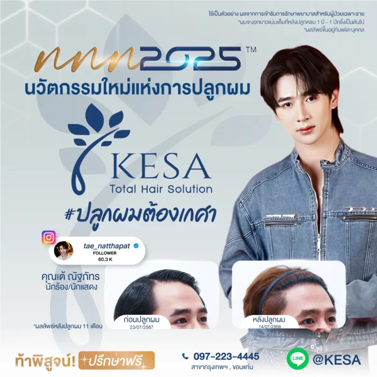 ปลูกผม ผู้หญิง