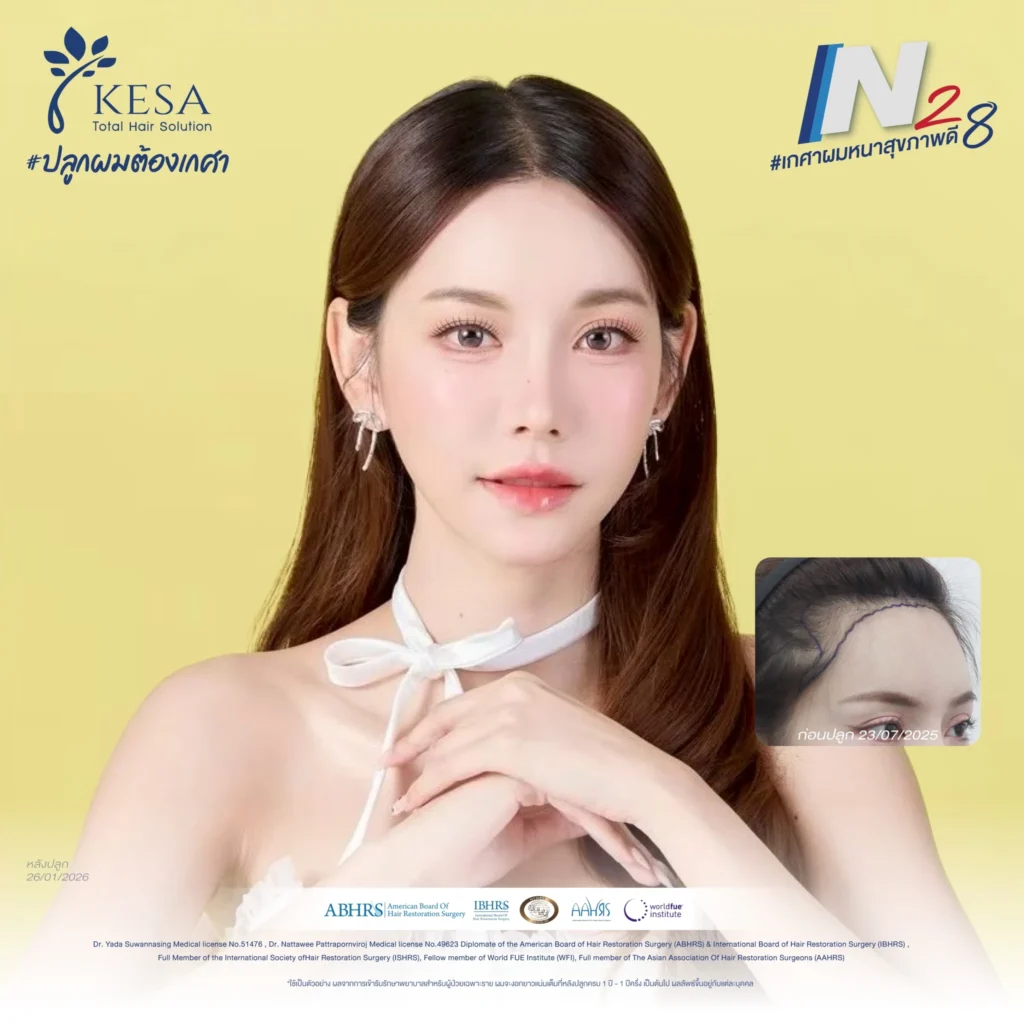 ปลูกผมผู้หญิง เกศา คลินิก - kesa hair clinic