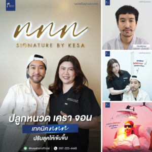 รีวิวปลูกหนวด