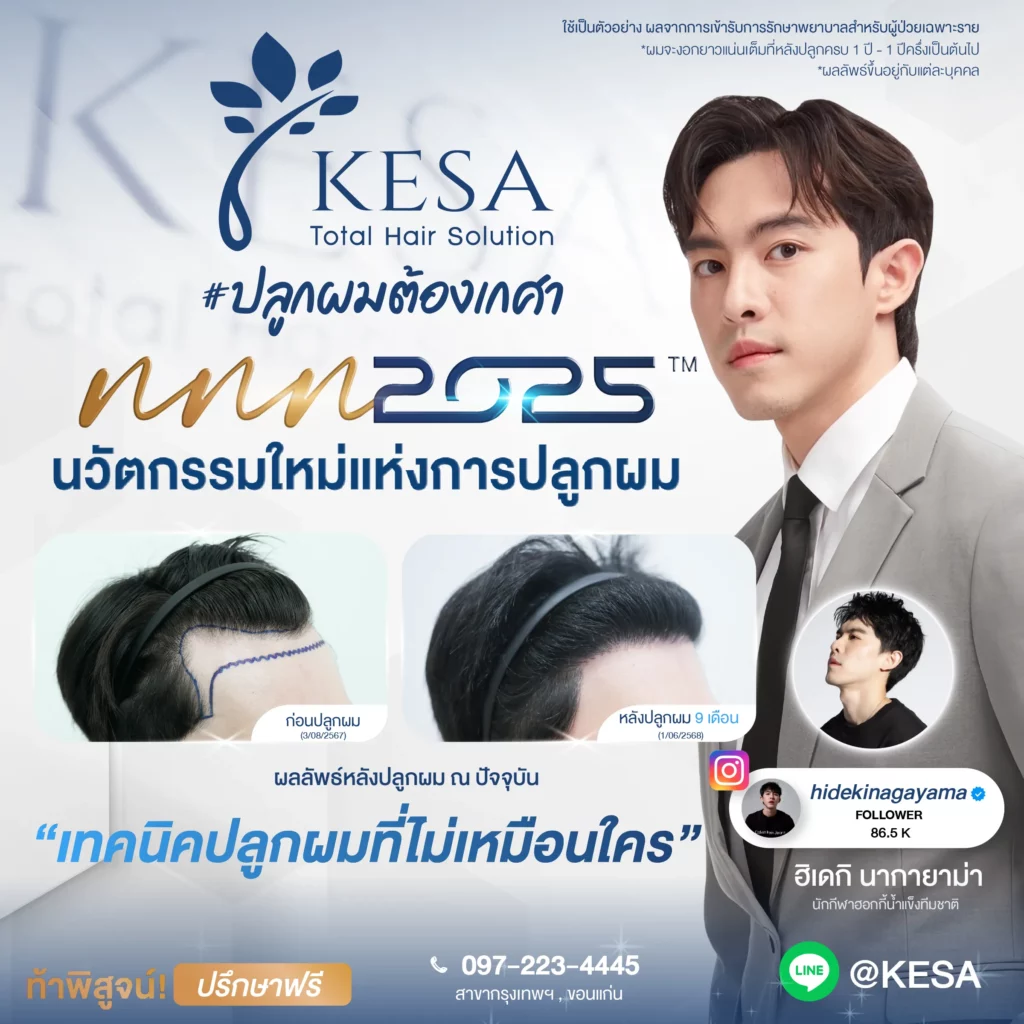NNN2025 นวัตกรรมใหม่แห่งการปลูกผม