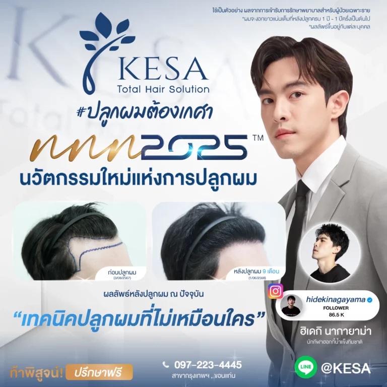 ปลูกผม ผู้ชาย