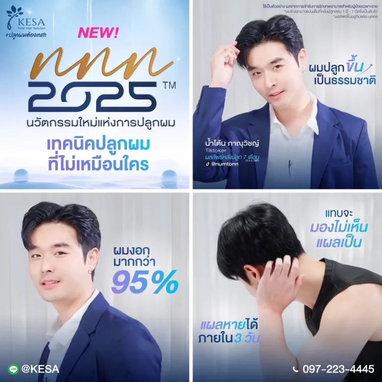 ปลูกผมไร้แผลคืออะไร