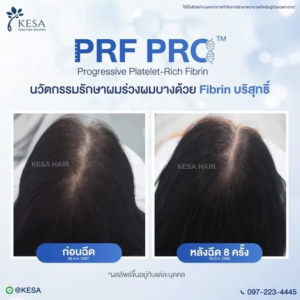 PRF PRO