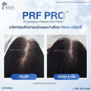 PRF PRO