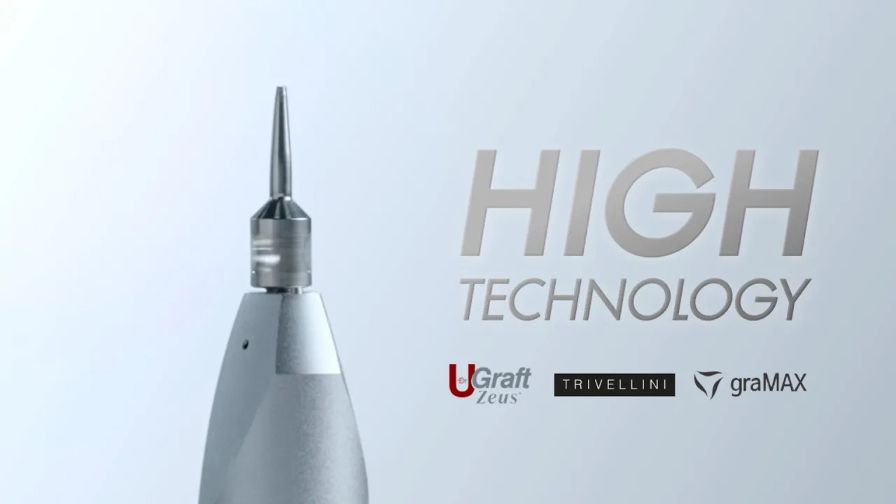 NNN นวัตกรรมใหม่แห่งการปลูกผม