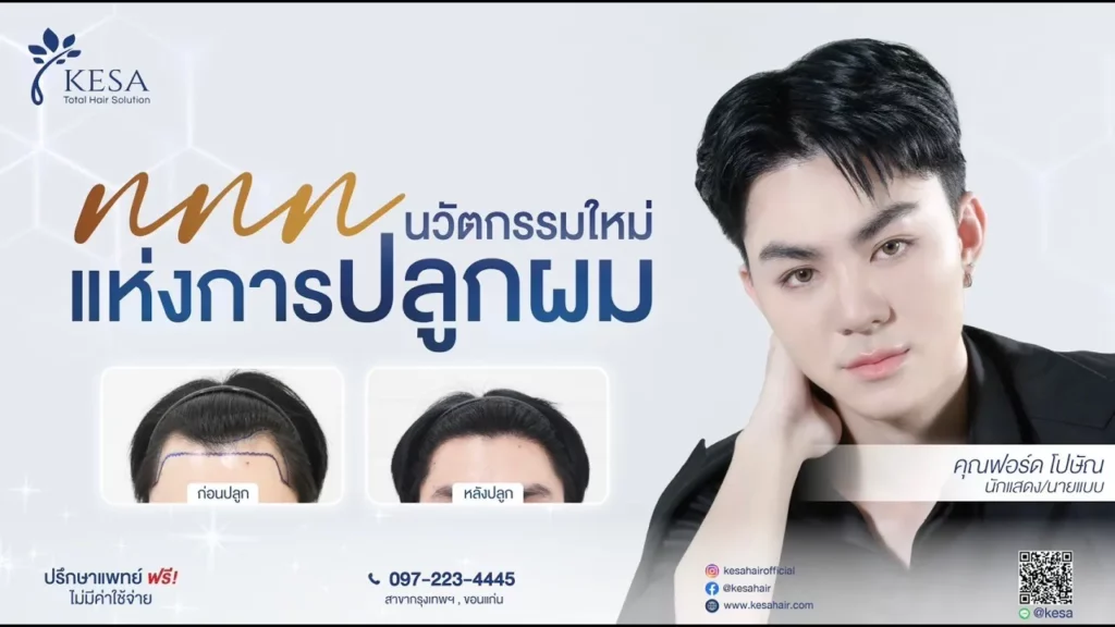 maxresdefault 3 เกศา คลินิก - kesa hair clinic เกศา คลินิก - kesa hair clinic