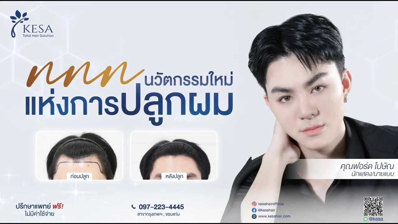 ปลูกผมแบบไม่มีรอยแผลเป็น เพราะเทคโนโลยีใหม่สุดของการปลูกผมแห่งเดียวที่ Kesa Clinic