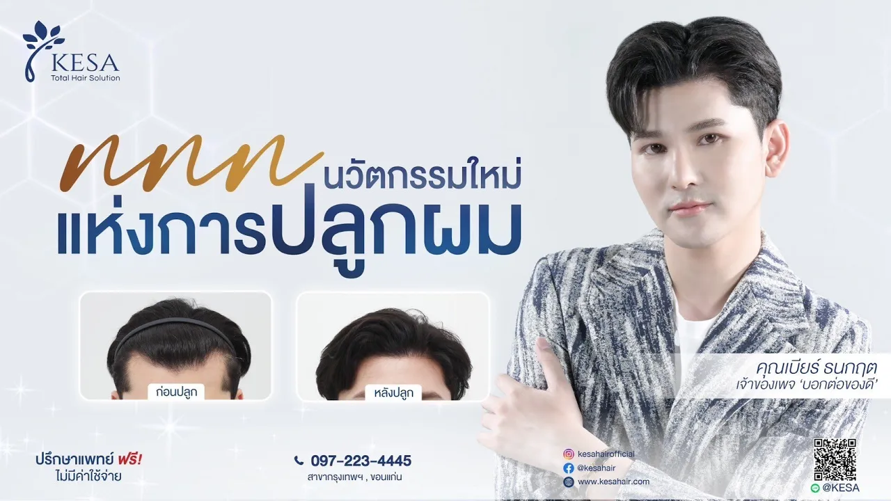ปลูกผมเทคนิคไหน? “ทำให้มองไม่เป็นแผลเป็น” ต้อง NNN นวัตกรรมใหม่แห่งการปลูกผม