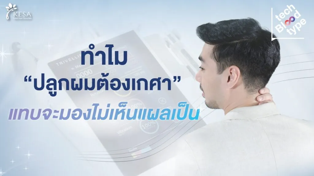 Tech Blood Type | ทำไม? ปลูกผมต้องเกศา ถึง “แทบจะมองไม่เห็นแผลเป็น”