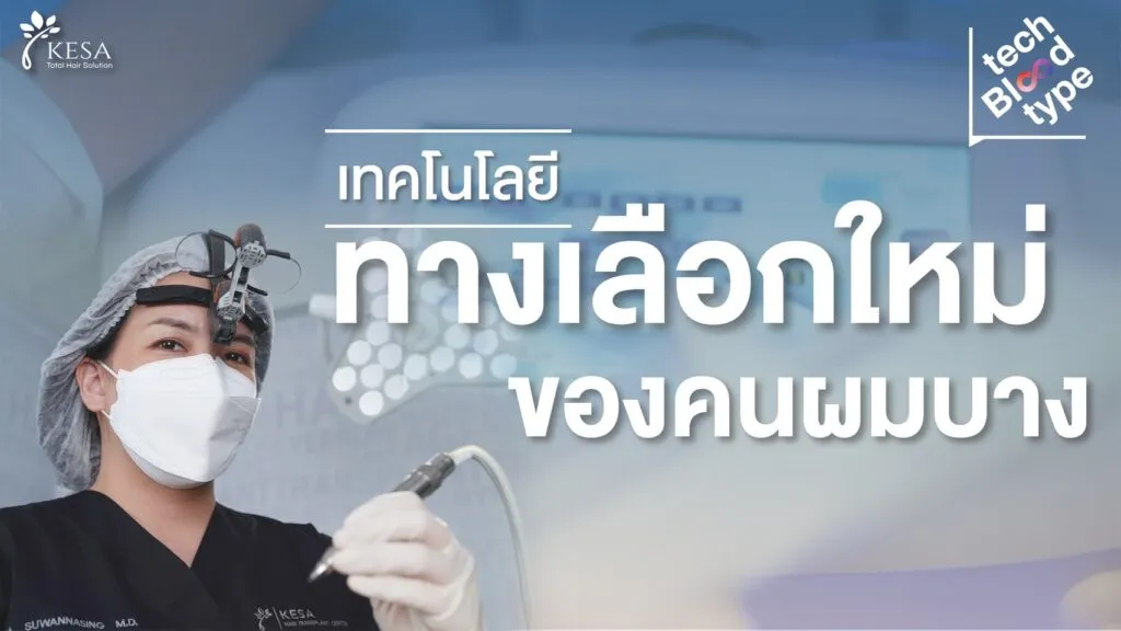 Tech Blood Type | รู้เร็ว! ยิ่งรักษาเร็วยิ่งดี! เทคโนโลยี รักษาผมบางกรรมพันธุ์