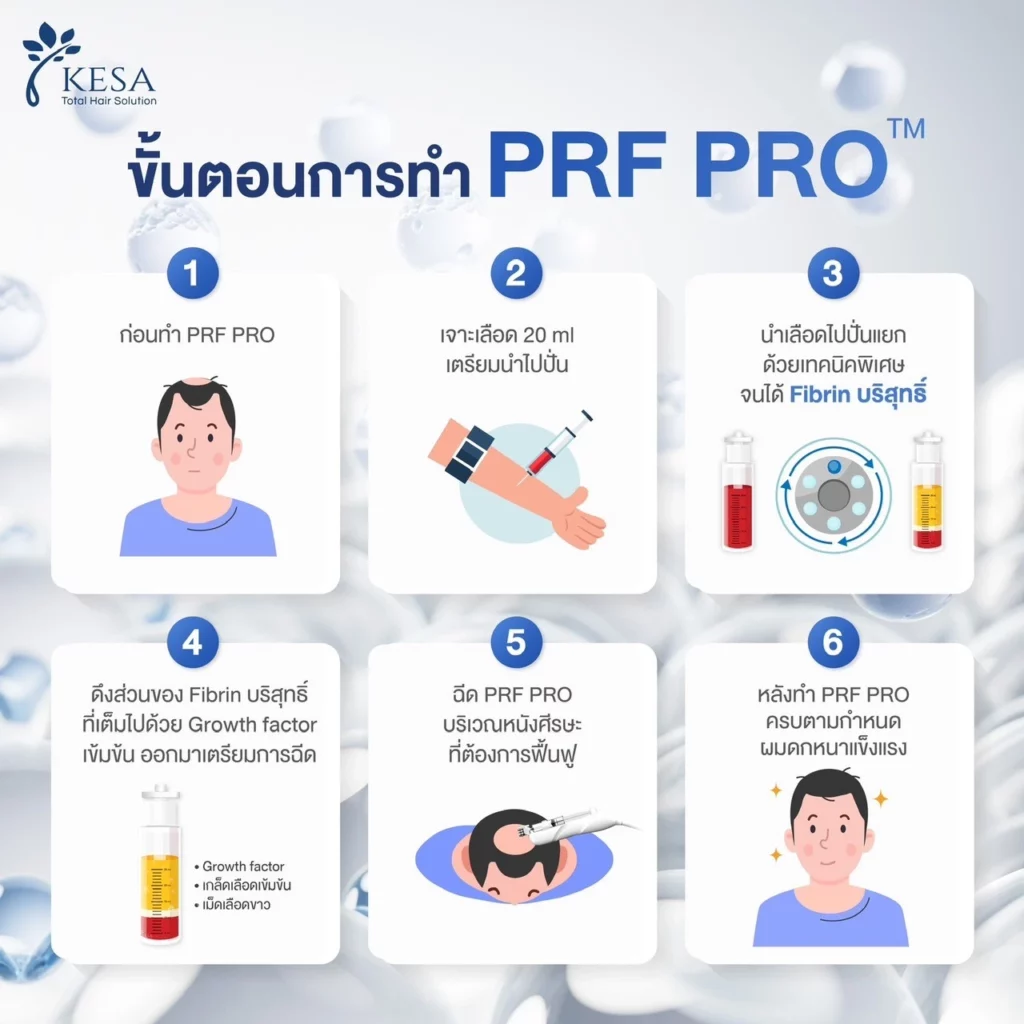 PRF เกศา คลินิก - kesa hair clinic