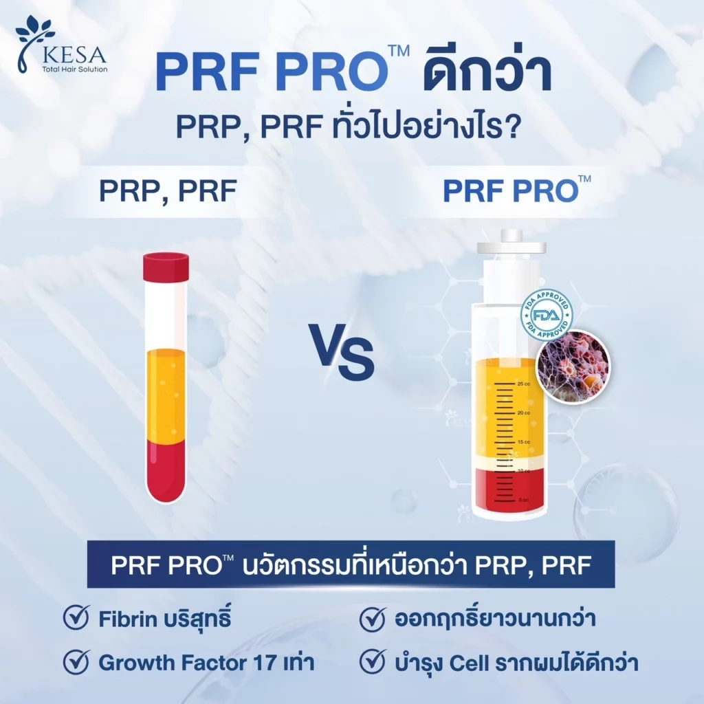 PRF เกศา คลินิก - kesa hair clinic