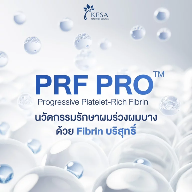 PRF
