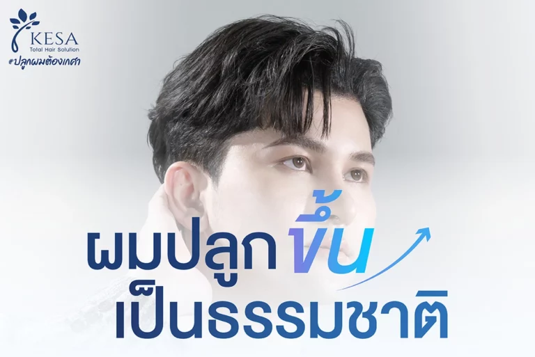ผมปลูกขึ้นเป็นธรรมชาติ เกศา คลินิก - kesa hair clinic