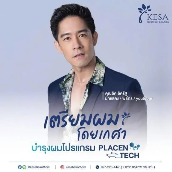 เตรียมผม
