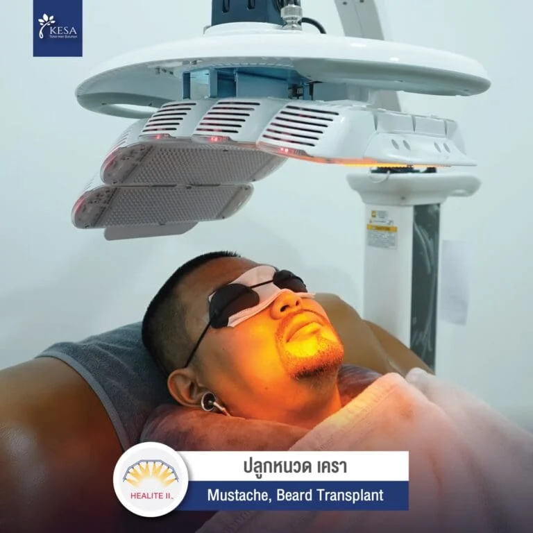 รีวิว-HEALITE-II