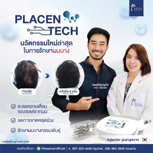 ปลูกผม เกศา คลินิก - kesa hair clinic