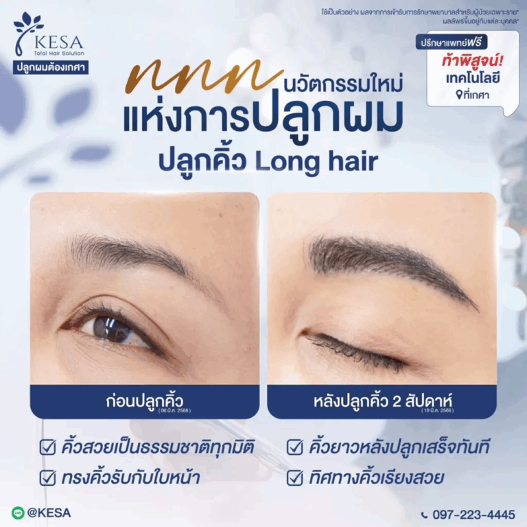 ปลูกคิ้วถาวร เกศา คลินิก - kesa hair clinic