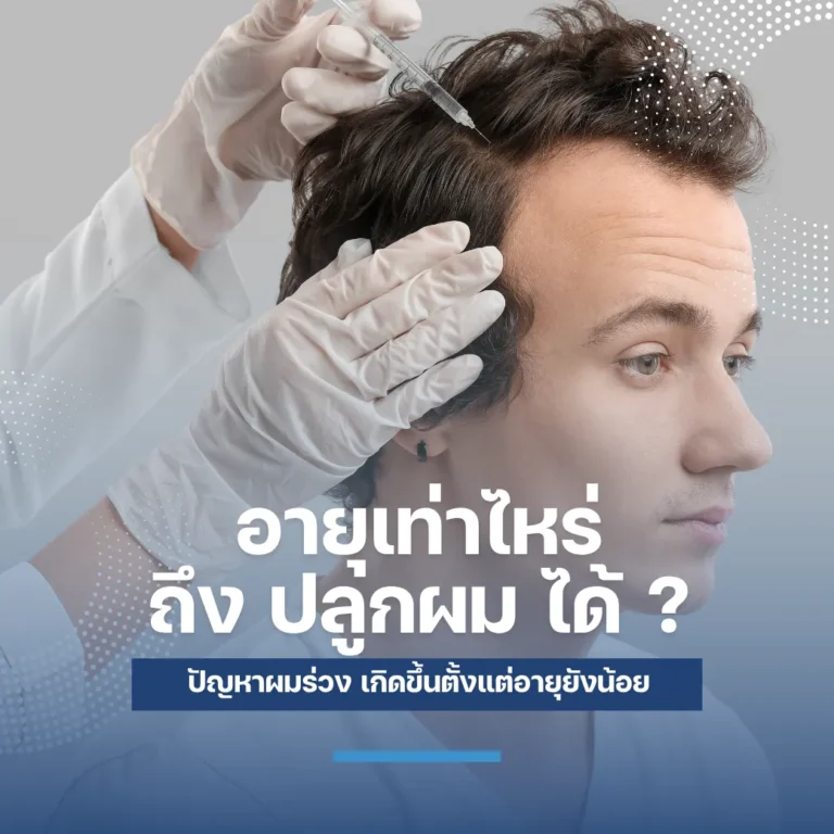 อายุเท่าไหร่ถึง ปลูกผม ได้ ? เกศา คลินิก - kesa hair clinic